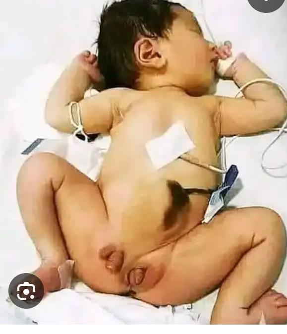 Individual with both male and female reproductive system.